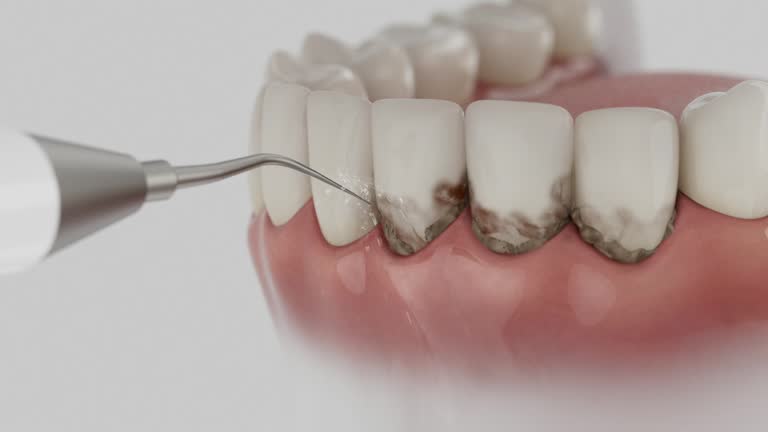 Trusted Teeth Cleaning And Checkup service in Six Shooter Canyon, AZ - Dentist Open Now